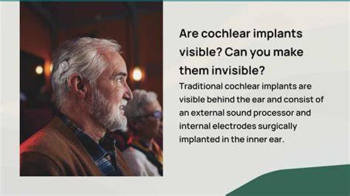 Are cochlear implants invisible