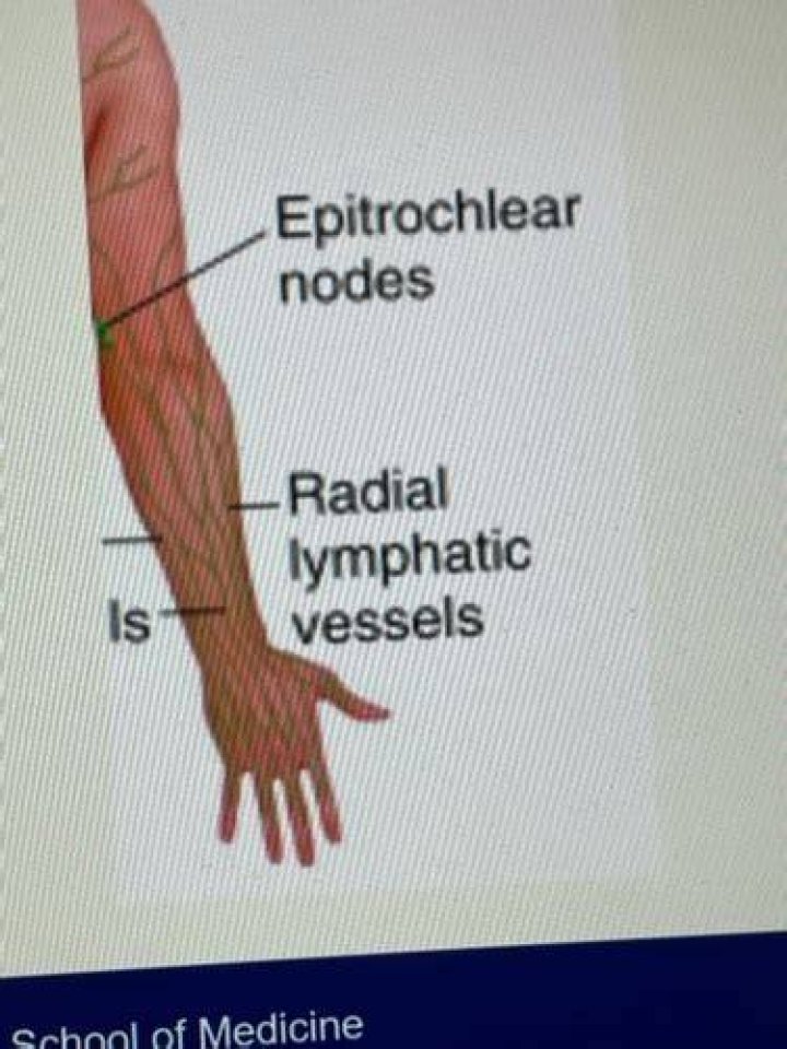 Are Epitrochlear nodes palpable
