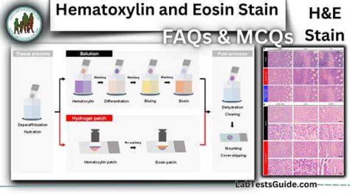How does H and E stain work