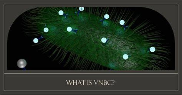 How does Vbnc detect