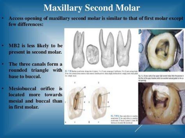 How many canals are in a lower second molar