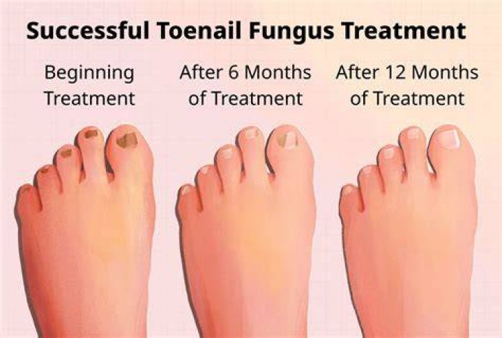 What does moms toenail do