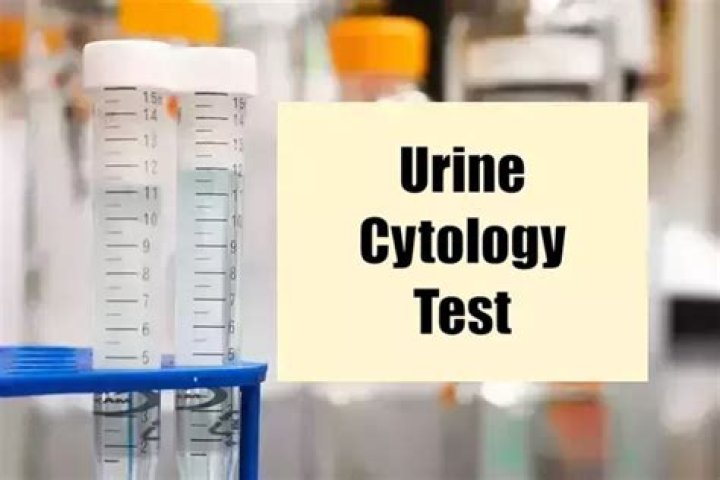 What is cytology urine test for