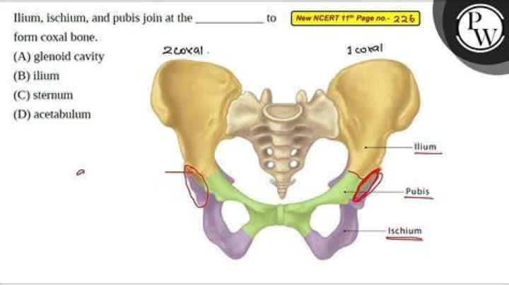 Which bone is formed by the ischium ilium and pubis