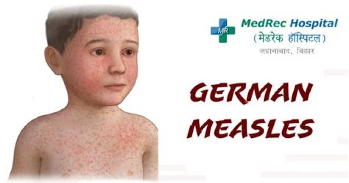 Who discovered German measles